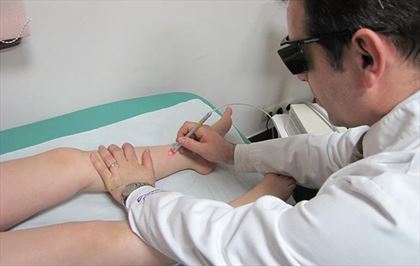 leczenie niewydolności żylnej